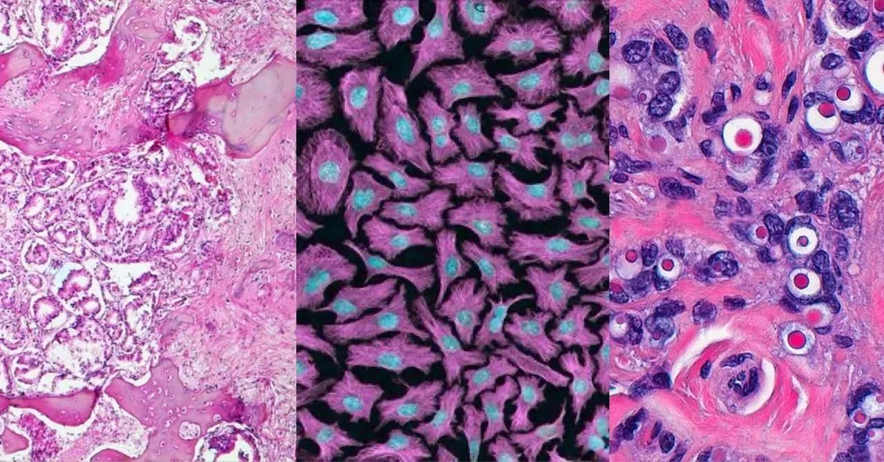 Vdoe FinGurú - Cáncer y metástasis: ¿a dónde migrar? por BIOclubs